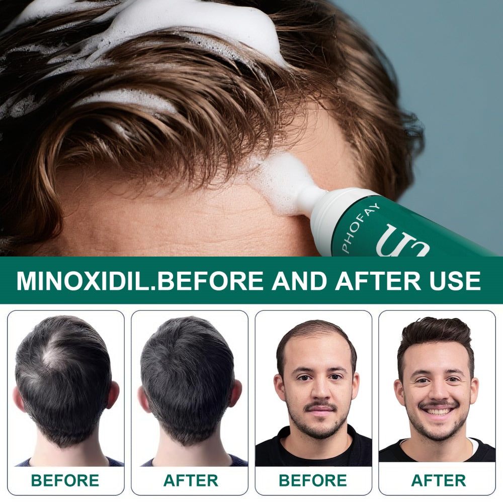 PHOFAY MINOXIDIL ANTI-HAARAUSFALL-MOUSSE