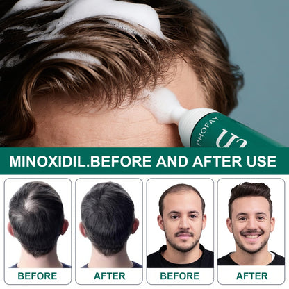 PHOFAY MINOXIDIL ANTI-HAARAUSFALL-MOUSSE 