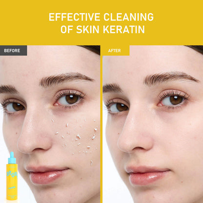 Phofay Exfoliating Set