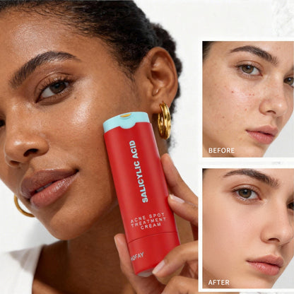 PHOFAY C S003 ACENE REMOVING LOTION